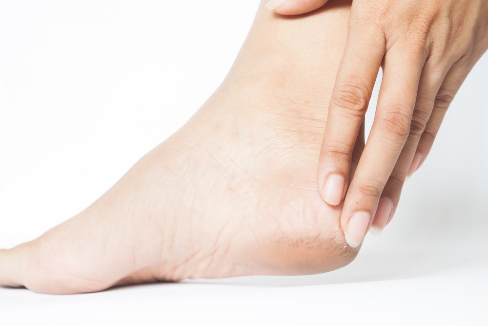 Heel care image 1